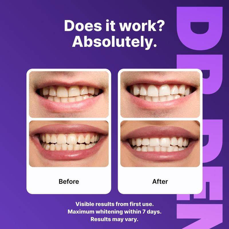 DRDENT Purple Teeth Whitening Strips - 7/21 Whitening Sessions - Safe for Enamel - Non Sensitive Teeth Whitening - Peroxide-Free